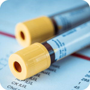 Image of two vials of blood resting on paperwork.